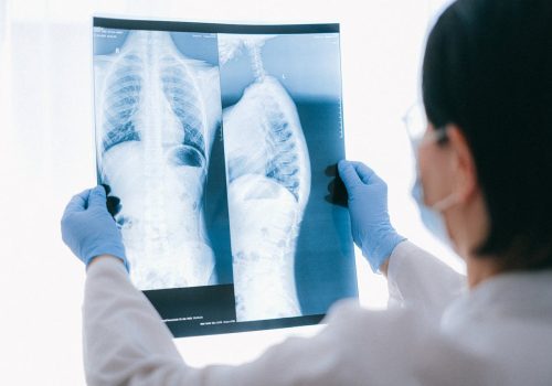 FeaturedPublications_Thumbnail_Lung Cancer Distribution, Risk Factors, and Temporal Trends for Lung Cancer Incidence and Mortality A Global Analysis